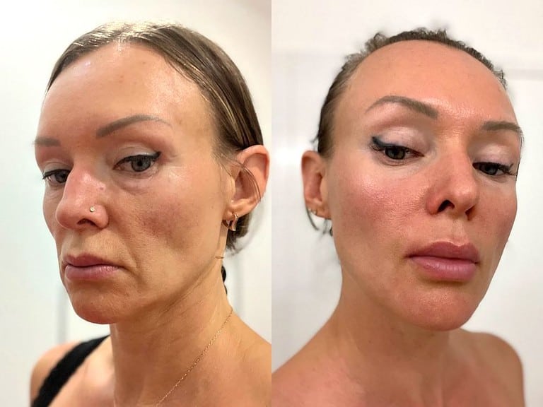 Gua Sha vorher nachher meine Erfahrungen rawexotic